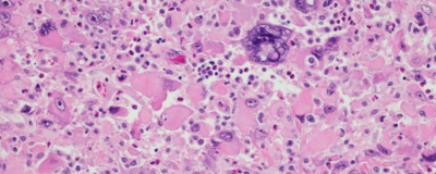 Endocrinology