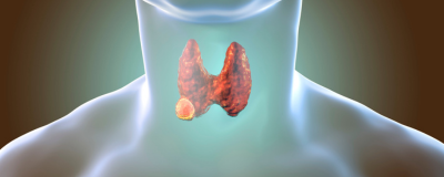 New study highlights the efficacy of thermal ablation for papillary thyroid carcinoma